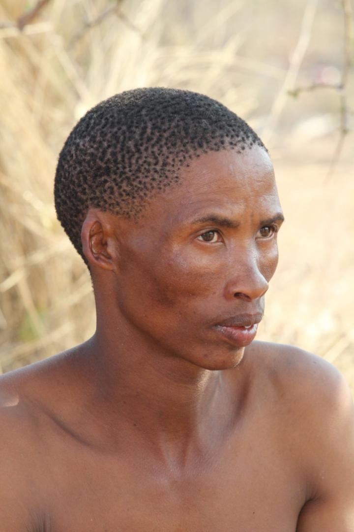 An Understanding of Pigmentation that is More than Just Skin Deep (6 of 9)