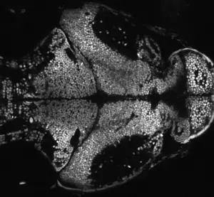 Brain calcium imaging