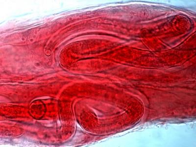 <I>Trichinella</I> in Muscle