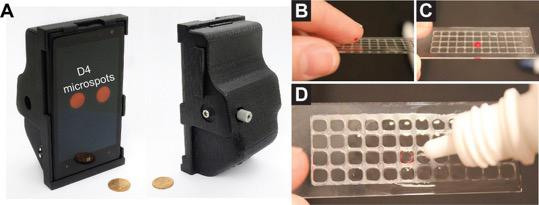 Smartphone Attachment