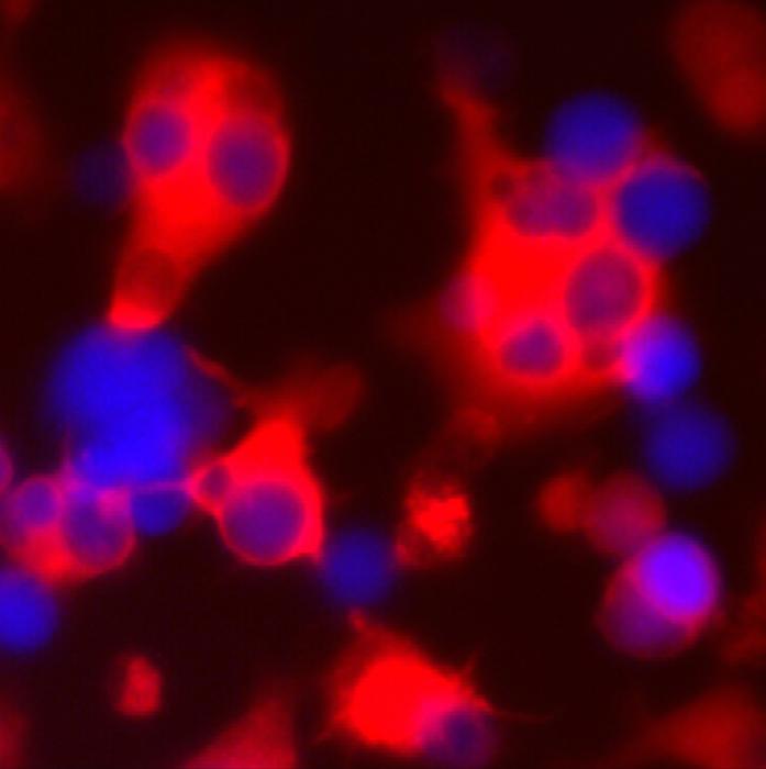 Engineered immune cells (red) attacking breast cancer cells (blue)