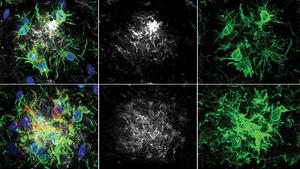 PTPB1 inhibitors in Alzheimer's disease