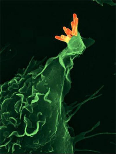 Tuberculosis Bacteria