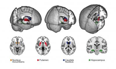 Your Brain on Video Games