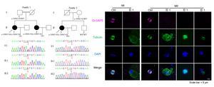 DLGAP5 mutations disrupt normal chromosome segregation and spindle formation of human oocyte meiosis and lead to female infertilit