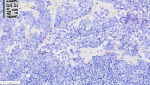 Low tRNA
