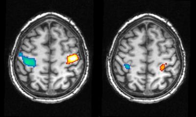 Dream Motor Cortex