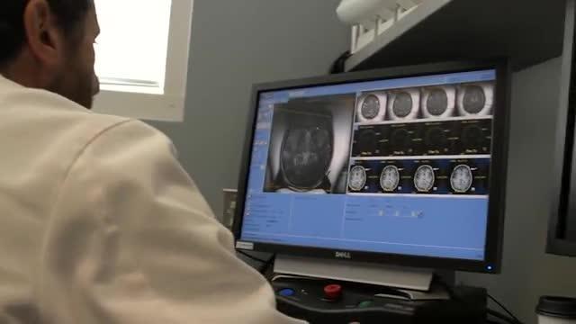 Brain Surgery Alternative Proves Safe, Effective for Treating Most Common Movement Disorder