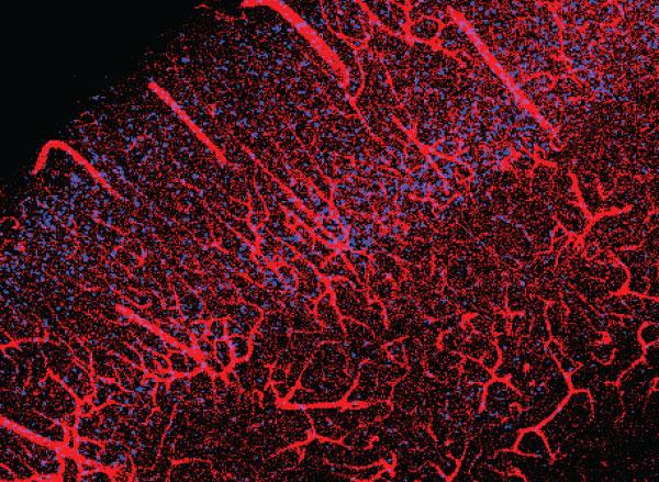 Brain vasculature