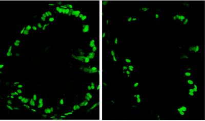 Impact of Microbes on Zebra Fish Intestines