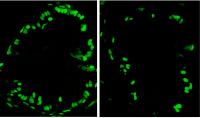 Impact of Microbes on Zebra Fish Intestines