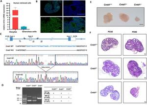 CNTD1 showed expression in oocytes, and Cntd1 knockout mice displayed prematurely depleted follicular pools