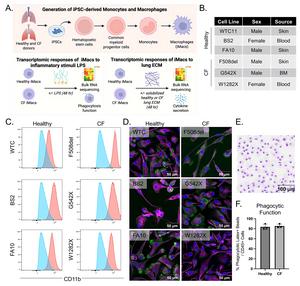 Overview of experimental strategy and derivation of iPSC-derived macrophages (iM0) from healthy and CF donors.
