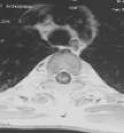 Enhanced Transverse