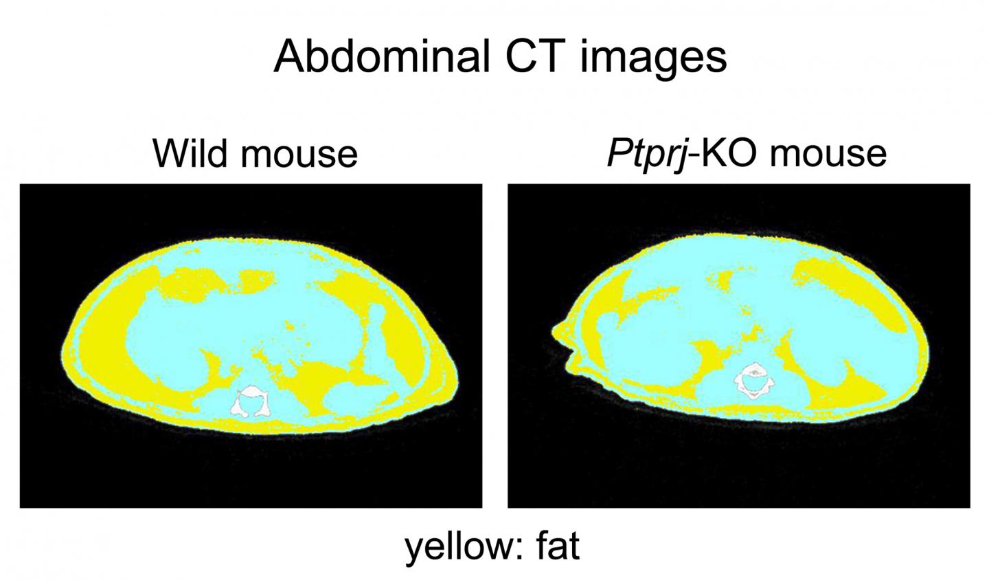 Representative CT Images of WT and KO Mice Fed HF/HSD at 16 Weeks of Age