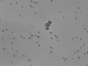 Microscopic scooter.