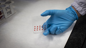 Diseñado un dispositivo basado en la física de microfluidos para predecir la respuesta terapéutica contra el cáncer