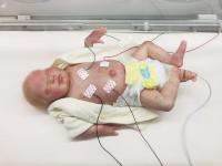 Baby Monitoring -- Traditional Method