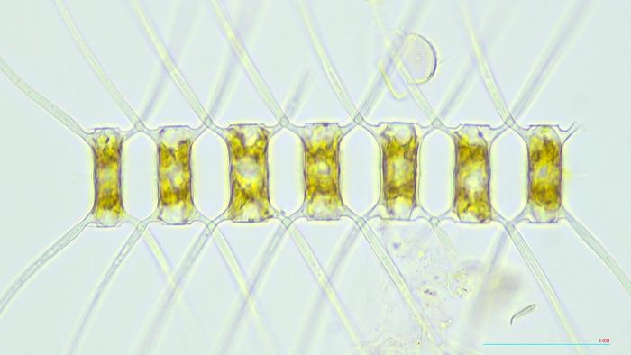 Chaetoceros atlanticus