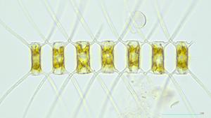 Chaetoceros atlanticus