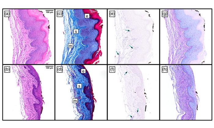 Raman spectroscopy for pelvic organ prolapse