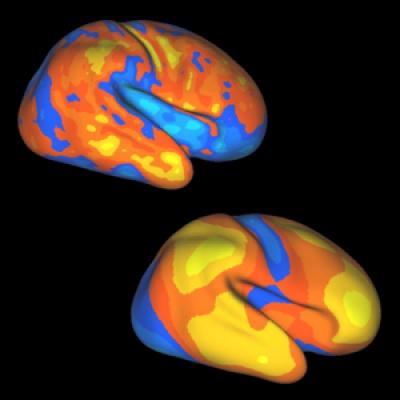 Brain Expansion Compared