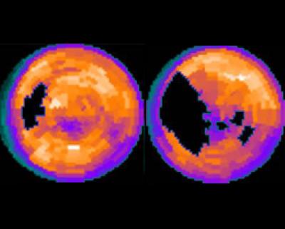 Image of the Heart
