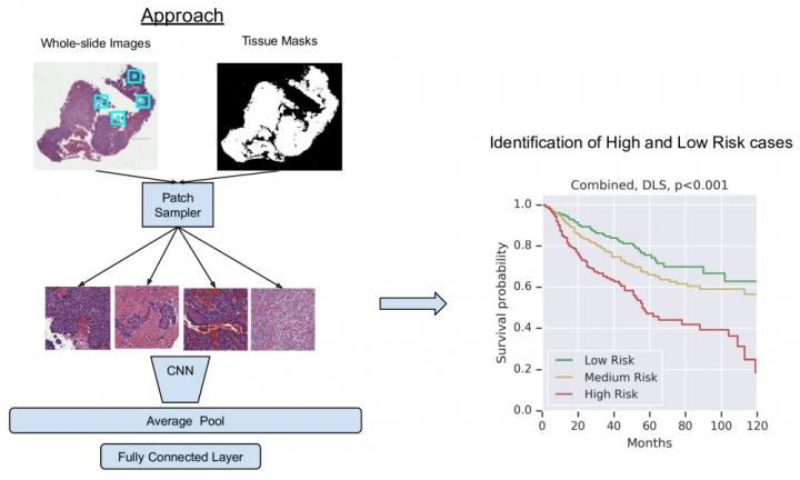 A machine-learning model shows promise in predicting cancer prognosis and survival