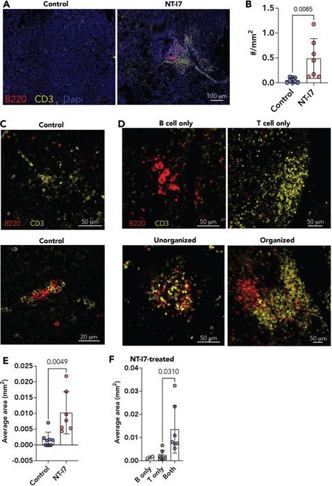 Presence and types of immune aggregates in control and NT-I7-treated tumor samples.