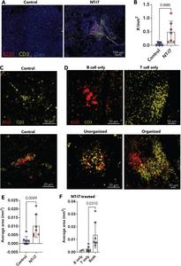 Presence and types of immune aggregates in control and NT-I7-treated tumor samples.