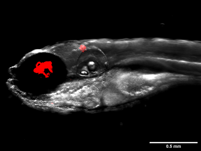 Zebrafish infected with fluorescent bacteria, Mycobacterium abscessus, shown in red