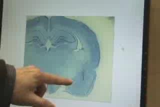 Research Discovers How Marijuana Affects the Way the Brain Processes Emotional Information