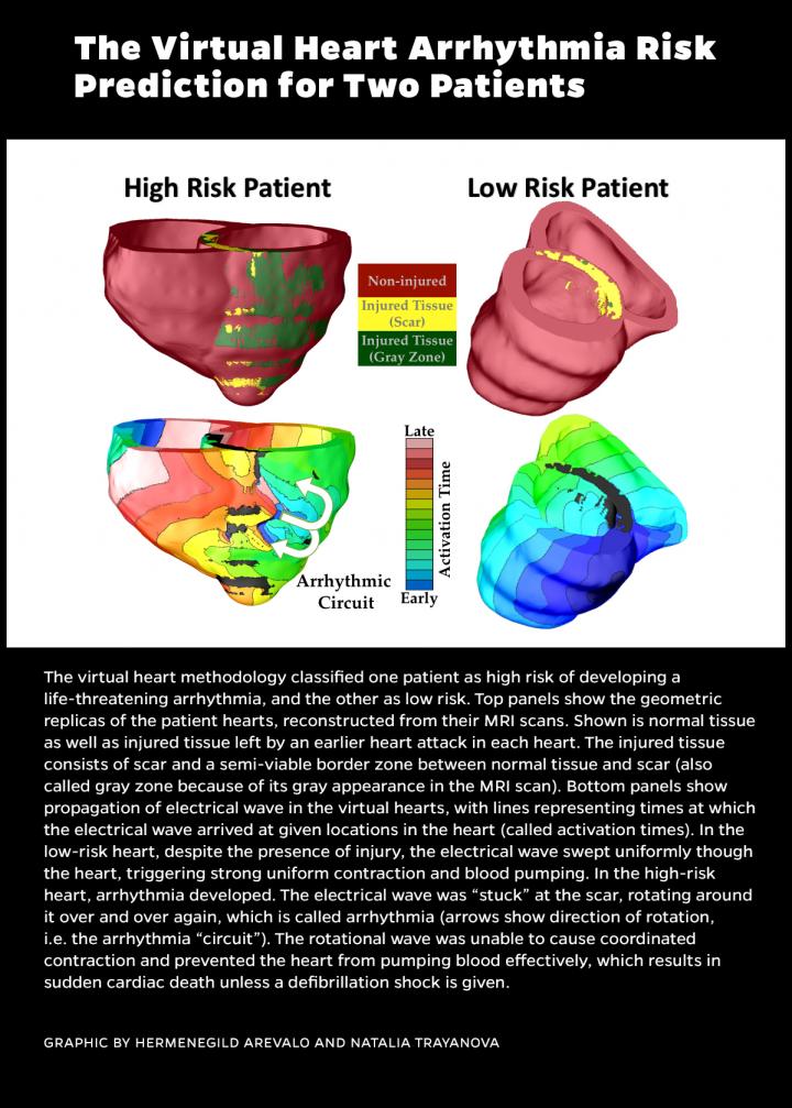 Arrythmia Graphic