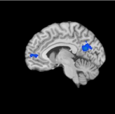 The Meditating Brain