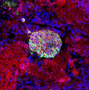 HFI-shielded islets displayed a round shape and well-preserved surface contour resembling pancreatic islets within the spleen.