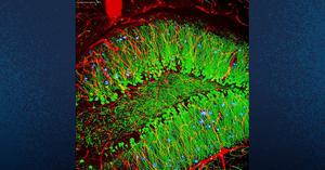 Mouse Brain