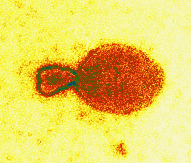 Hendra Virus