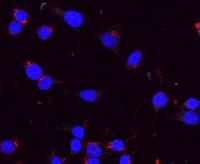 Human Beta Cells Grown in Culture