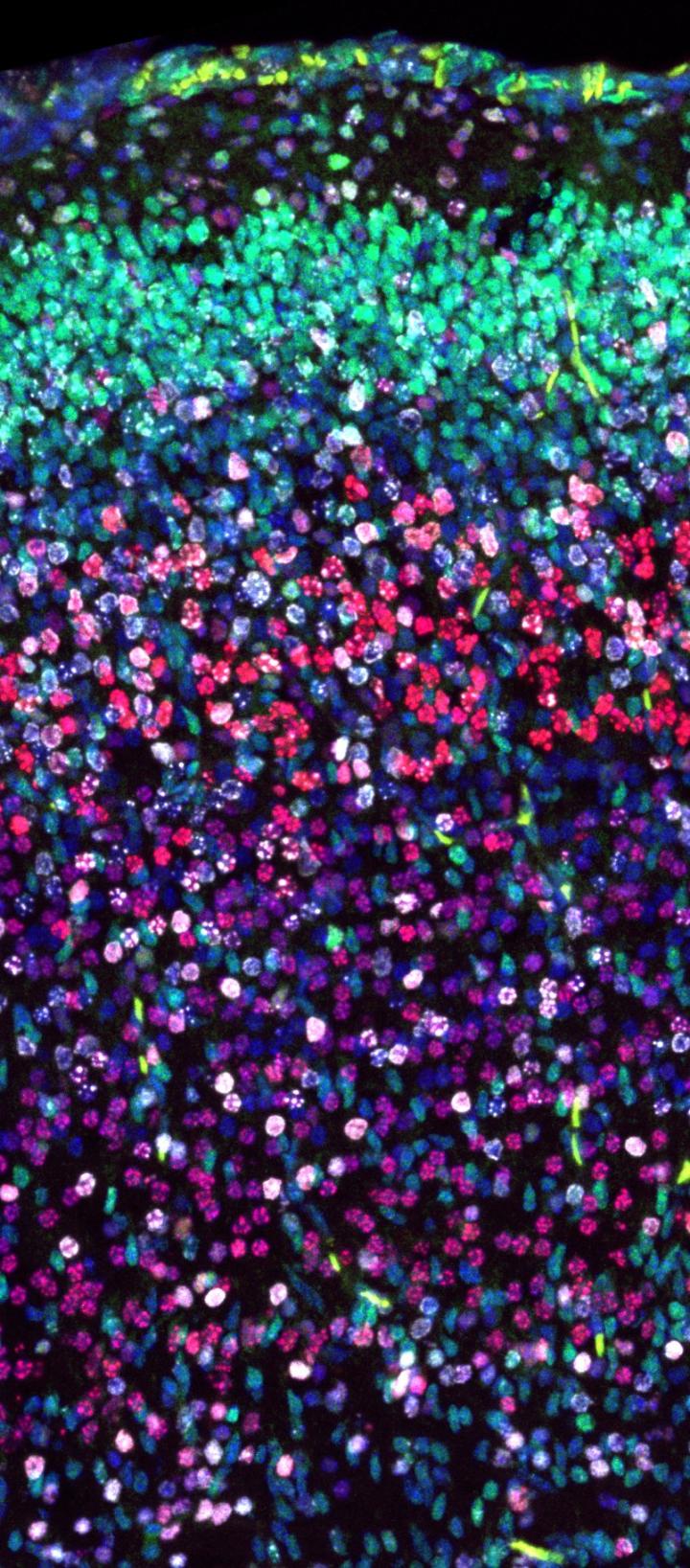 Brain cells migrate slower