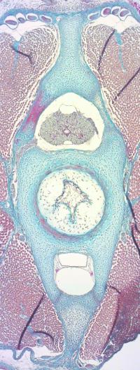 Cross-Section of a Little Skate Vertebra