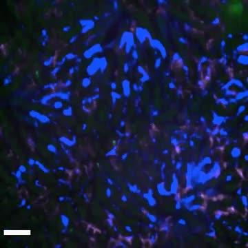 Introduction of Alpha Toxin