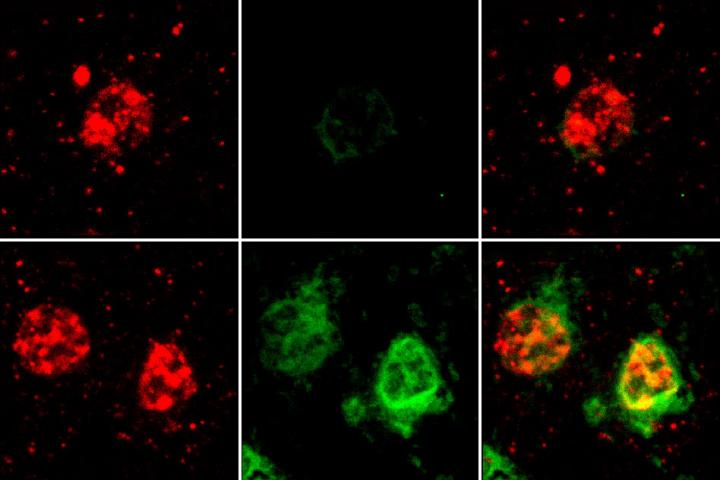 Alzheimer's Genes