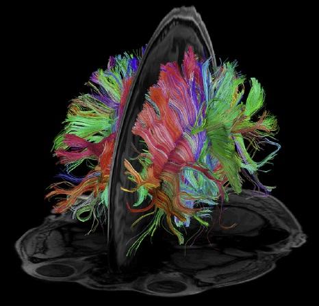 Brain Imaging