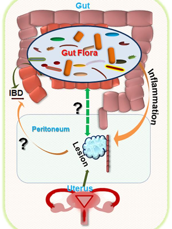 Endometriosis and Gut Microbiome