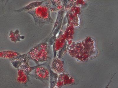Matrix Stiffness Essential to Stem Cell Differentiation (1 of 3)