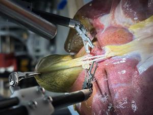 Surgical Robot Transformer-Hierarchy performs surgery