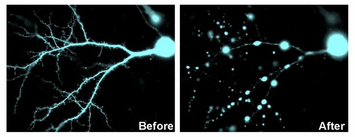 Neuron