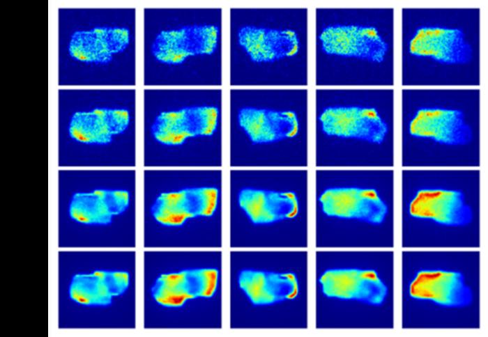 Comparison of EPID transmission dose (TD) images before and after denoising