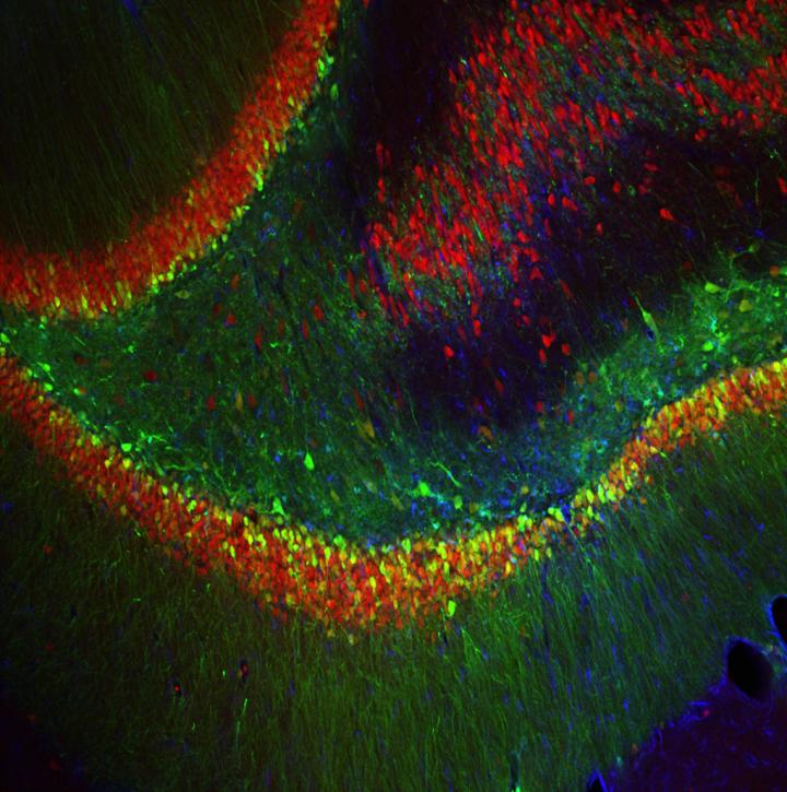 Brain Cells with Blocked FGF9 Production