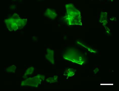 Web-like Traps Identified as Priming Mechanism for Atherosclerosis Pathway (2 of 2)